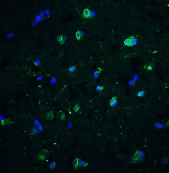 IHC-P analysis of human brain tissue using GTX31381 CD81 antibody. Working concentration : 10 microg/ml