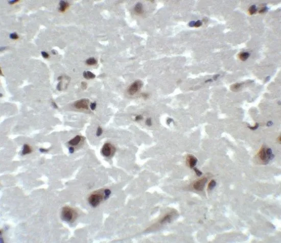 IHC-P analysis of human brain tissue using GTX31381 CD81 antibody. Working concentration : 2 microg/ml