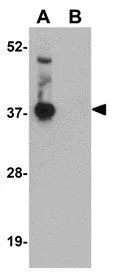 WB analysis of human brain tissue lysate in (A) the absence and (B) the presence of blocking peptide using GTX31384 C20orf11 antibody. Working concentration : 1 microg/ml WB analysis of human brain tissue lysate in (A) the absence and (B) the presence of blocking peptide using GTX31384 C20orf11 antibody. Working concentration : 1 microg/ml