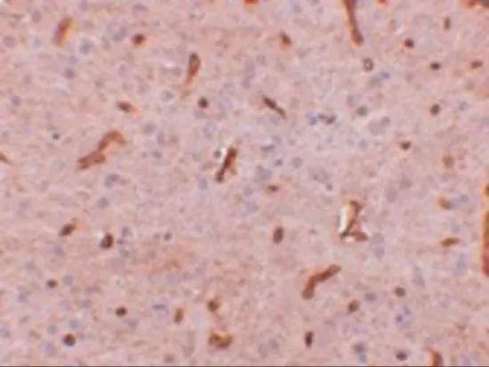 IHC-P analysis of rat brain tissue using GTX31384 C20orf11 antibody. Working concentration : 2.5 microg/ml