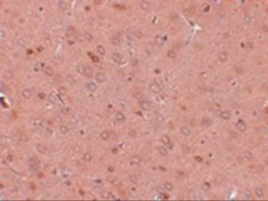 WB analysis of rat brain tissue lysate using GTX31391 GOLPH2 antibody. Working concentration : (A) 0.25 and (B) 0.5 ug/ml