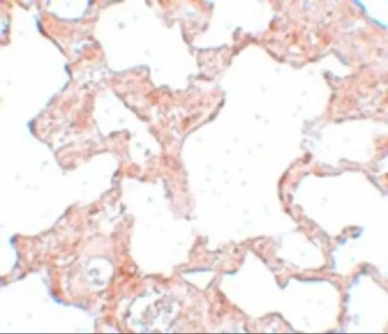 IHC-P analysis of rat lung tissue using GTX31396 SGK493 antibody. Working concentration : 2.5 microg/ml