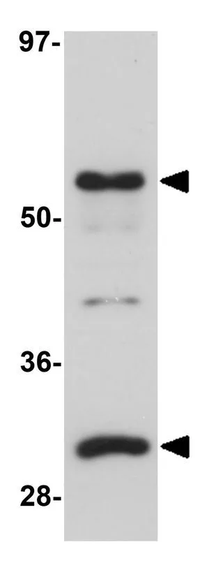 WB analysis of human lung tissue lysate using GTX31396 SGK493 antibody. Working concentration : 1 microg/ml