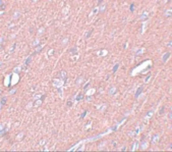 IHC-P analysis of rat brain tissue using GTX31397 Synaptogyrin 3 antibody. Working concentration : 2.5 microg/ml IHC-P analysis of rat brain tissue using GTX31397 Synaptogyrin 3 antibody. Working concentration : 2.5 microg/ml