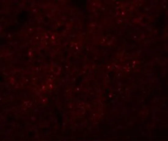 IHC-P analysis of rat brain tissue using GTX31397 Synaptogyrin 3 antibody. Working concentration : 20 microg/ml