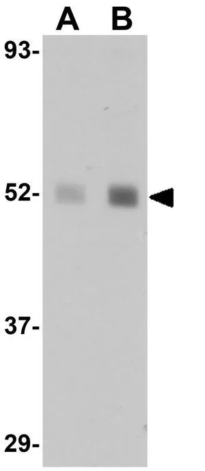 WB analysis of human lung tissue lysate using GTX31398 LXR beta antibody. Working concentration : (A) 1 and (B) 2 microg/ml WB analysis of human lung tissue lysate using GTX31398 LXR beta antibody. Working concentration : (A) 1 and (B) 2 microg/ml