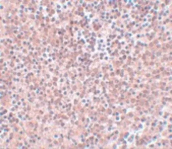 IHC-P analysis of human spleen tissue using GTX31400 Nanog antibody. Working concentration : 5 microg/ml IHC-P analysis of human spleen tissue using GTX31400 Nanog antibody. Working concentration : 5 microg/ml