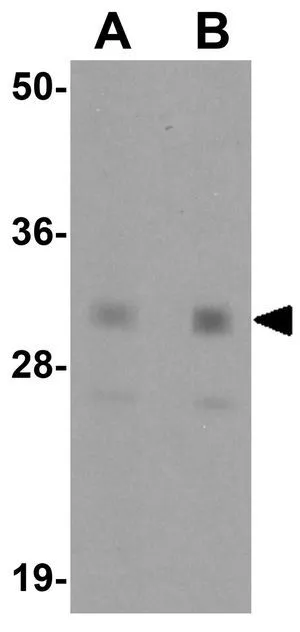 WB analysis of human spleen tissue lysate using GTX31400 Nanog antibody. Working concentration : (A) 1 and (B) 2 microg/ml