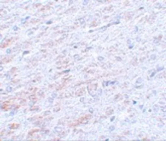 IHC-P analysis of rat liver tissue using GTX31402 TCF3 / E2A antibody. Working concentration : 5 microg/ml