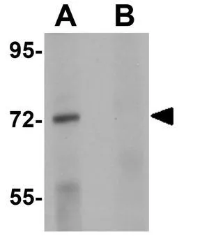 WB analysis of human brain tissue lysate in (A) the absence and (B) presence of blocking peptide using GTX31402 TCF3 / E2A antibody. Working concentration : 1 microg/ml