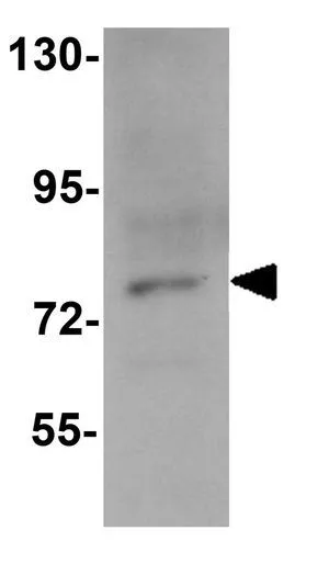 WB analysis of K562 cell lysate using GTX31412 PIAS3 antibody. Working concentration : 1 microg/ml