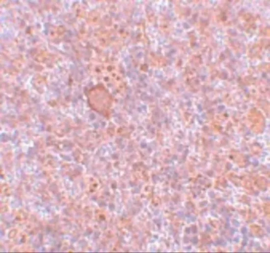 IHC-P analysis of rat spleen tissue using GTX31413 CtIP antibody. Working concentration : 5 microg/ml IHC-P analysis of rat spleen tissue using GTX31413 CtIP antibody. Working concentration : 5 microg/ml