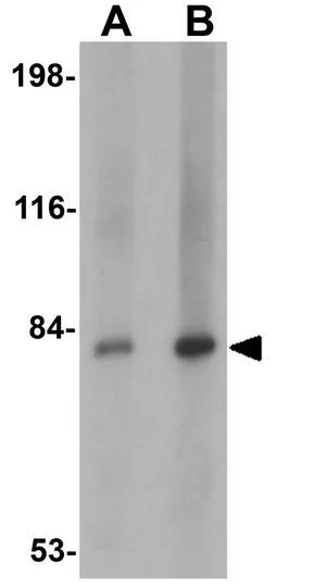 WB analysis of mouse spleen tissue lysate using GTX31413 CtIP antibody. Working concentration : (A) 1 and (B) 2 microg/ml