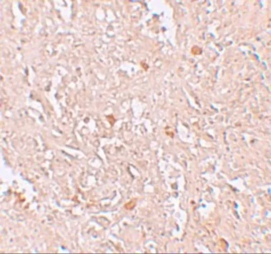 IHC-P analysis of human spleen tissue using GTX31424 FBXL16 antibody. Working concentration : 5 microg/ml IHC-P analysis of human spleen tissue using GTX31424 FBXL16 antibody. Working concentration : 5 microg/ml