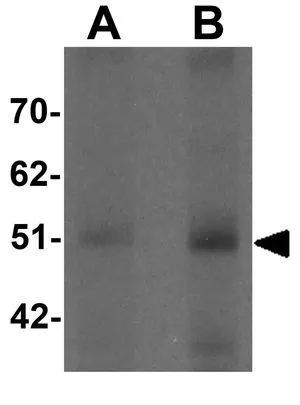 WB analysis of human spleen tissue lysate using GTX31424 FBXL16 antibody. Working concentration : (A) 0.5 and (B) 1 microg/ml