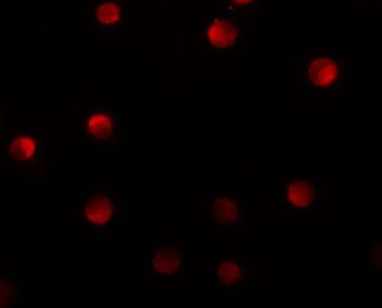 ICC/IF analysis of HeLa cells using GTX31425 N4BP1 antibody. Working concentration : 20 microg/ml