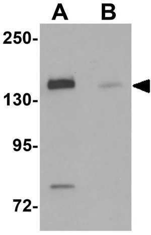 WB analysis of HeLa cell lysate in (A) the absence and (B) the presence of blocking peptide using GTX31425 N4BP1 antibody. Working concentration : 0.5 microg/ml