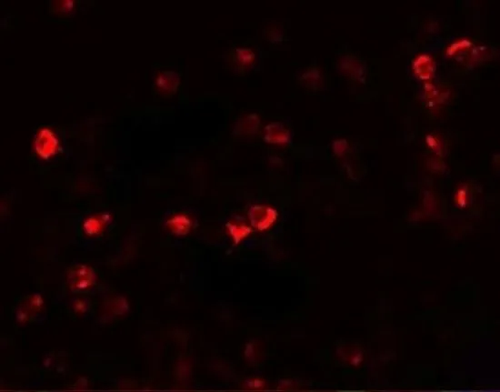 ICC/IF analysis of Daudi cells using GTX31426 OGFOD1 antibody. Working concentration : 20 microg/ml ICC/IF analysis of Daudi cells using GTX31426 OGFOD1 antibody. Working concentration : 20 microg/ml