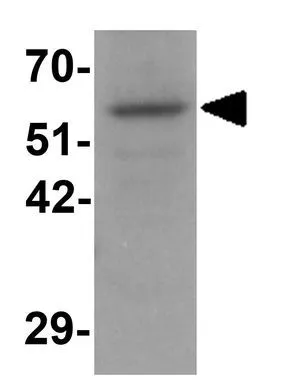 WB analysis of Daudi cell lysate using GTX31426 OGFOD1 antibody. Working concentration : 1 microg/ml