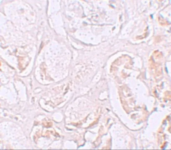 IHC-P analysis of human kidney tissue using GTX31427 SLAMF9 antibody. Working concentration : 2.5 microg/ml IHC-P analysis of human kidney tissue using GTX31427 SLAMF9 antibody. Working concentration : 2.5 microg/ml