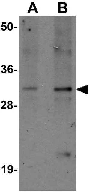 WB analysis of mouse kidney tissue lysate using GTX31427 SLAMF9 antibody. Working concentration : (A) 1 and (B) 2 microg/ml
