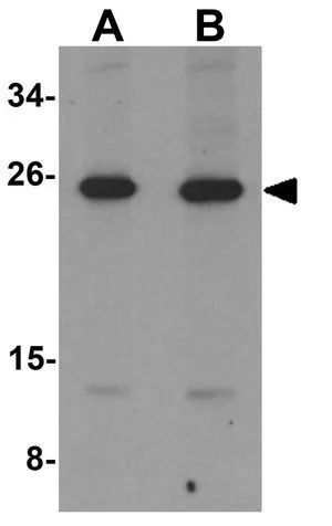 WB analysis of 3T3 cell lysate using GTX31431 LIF antibody. Working concentration : (A) 1 and (B) 2 ug/ml