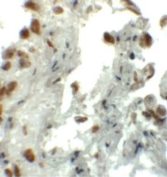 IHC-P analysis of human lung tissue using GTX31434 EZH1 antibody. Working concentration : 5 microg/ml IHC-P analysis of human lung tissue using GTX31434 EZH1 antibody. Working concentration : 5 microg/ml