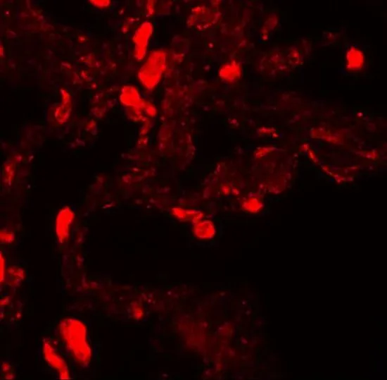 IHC-P analysis of human lung tissue using GTX31434 EZH1 antibody. Working concentration : 20 microg/ml