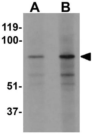 WB analysis of mouse lung tissue lysate using GTX31434 EZH1 antibody. Working concentration : (A) 1 and (B) 2 microg/ml