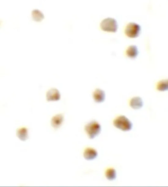 ICC/IF analysis of 293 cells using GTX31435 EZH2 antibody. Working concentration : 10 microg/ml ICC/IF analysis of 293 cells using GTX31435 EZH2 antibody. Working concentration : 10 microg/ml