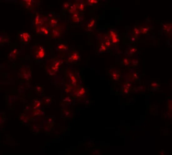 ICC/IF analysis of 293 cells using GTX31435 EZH2 antibody. Working concentration : 20 microg/ml
