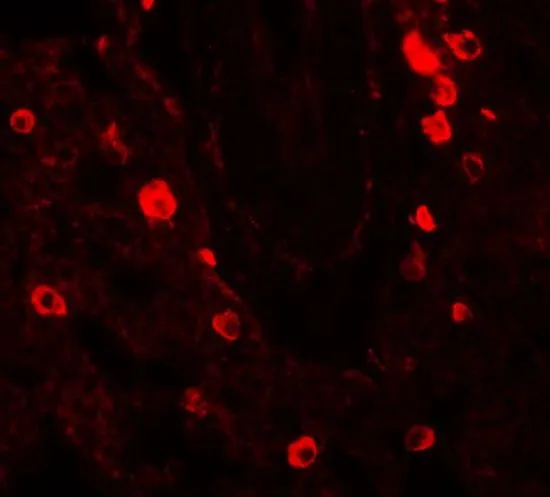 IHC-P analysis of human lung tissue using GTX31439 NUMB antibody. Working concentration : 20 microg/ml