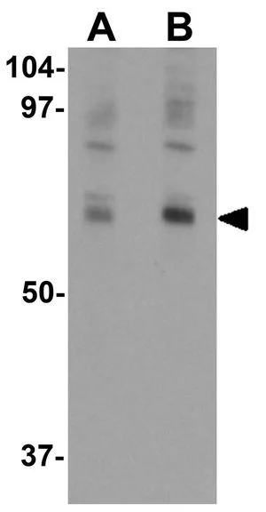 WB analysis of mouse lung tissue lysate using GTX31439 NUMB antibody. Working concentration : (A) 0.25 and (B) 0.5 microg/ml