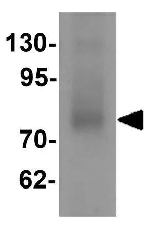WB analysis of human lung tissue lysate using GTX31441 TYW1 antibody. Working concentration : 1 microg/ml