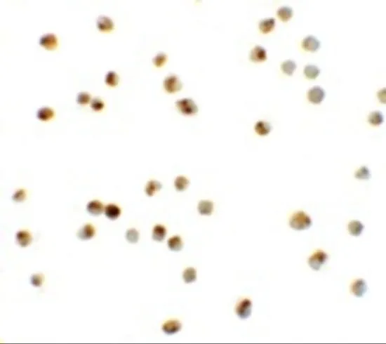 ICC/IF analysis of Daudi cells using GTX31444 ATAD3A antibody. Working concentration : 20 microg/ml