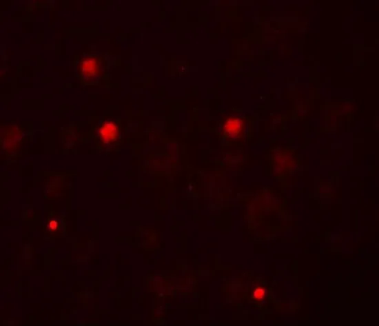 IHC-P analysis of human brain tissue using GTX31448 KCNK13 antibody. Working concentration : 20 microg/ml