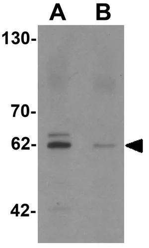 WB analysis of rat brain tissue lysate in (A) the absence and (B) the presence of blocking peptide using GTX31448 KCNK13 antibody. Working concentration : 0.5 microg/ml