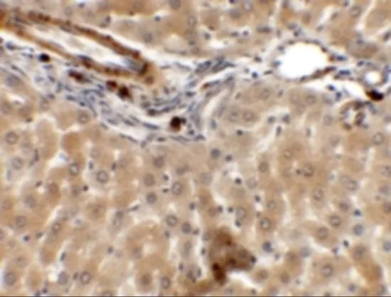 IHC-P analysis of rat liver tissue using GTX31450 IFLTD1 antibody. Working concentration : 5 microg/ml IHC-P analysis of rat liver tissue using GTX31450 IFLTD1 antibody. Working concentration : 5 microg/ml