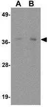 WB analysis of rat liver tissue lysate using GTX31450 IFLTD1 antibody. Working concentration : (A) 1 and (B) 2 microg/ml