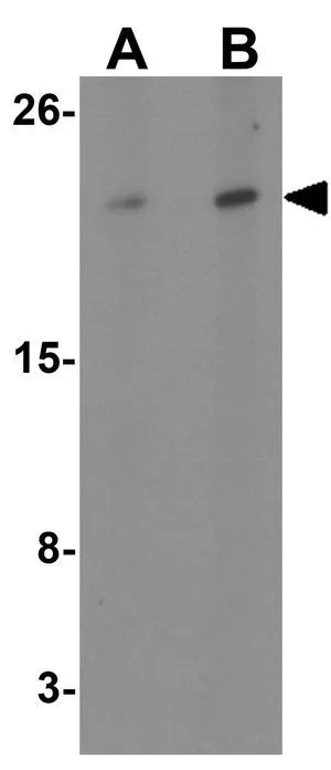 WB analysis of Daudi cell lysate using GTX31452 Transmembrane protein 147 antibody. Working concentration : (A) 1 and (B) 2 microg/ml WB analysis of Daudi cell lysate using GTX31452 Transmembrane protein 147 antibody. Working concentration : (A) 1 and (B) 2 microg/ml