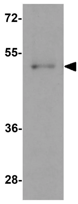 WB analysis of A-20 cell lysate using GTX31461 SPATA6 antibody. Working concentration : 1 microg/ml