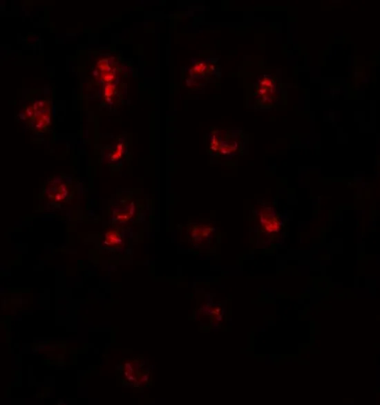 ICC/IF analysis of A-20 cells using GTX31472 TSHZ1 antibody. Working concentration : 20 ug/ml