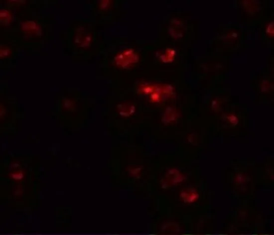 ICC/IF analysis of A-20 cells using GTX31473 TSHZ2 antibody. Working concentration : 20 microg/ml ICC/IF analysis of A-20 cells using GTX31473 TSHZ2 antibody. Working concentration : 20 microg/ml