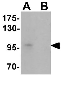 WB analysis of A-20 cell lysate in (A) the absence and (B) the presence of blocking peptide using GTX31473 TSHZ2 antibody. Working concentration : 1 microg/ml