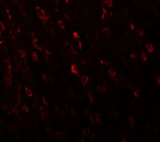 IHC-P analysis of mouse brain tissue using GTX31474 ZNF537 antibody. Working concentration : 20 microg/ml