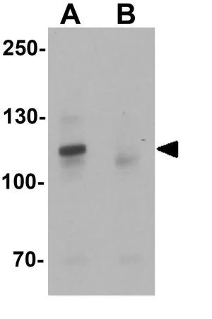 WB analysis of mouse brain tissue lysate in (A) the absence and (B) the presence of blocking peptide using GTX31474 ZNF537 antibody. Working concentration : 1 microg/ml