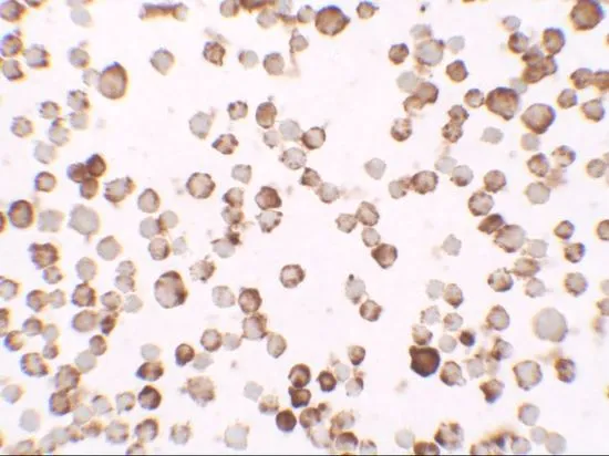 ICC/IF analysis of SW480 cells using GTX31475 Ribonuclease T2 antibody. Working concentration : 2.5 microg/ml