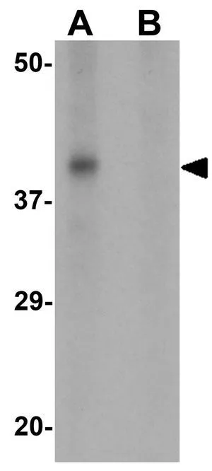 WB analysis of SW480 cell lysate in (A) the absence and (B) the presence of blocking peptide using GTX31475 Ribonuclease T2 antibody. Working concentration : 1 microg/ml