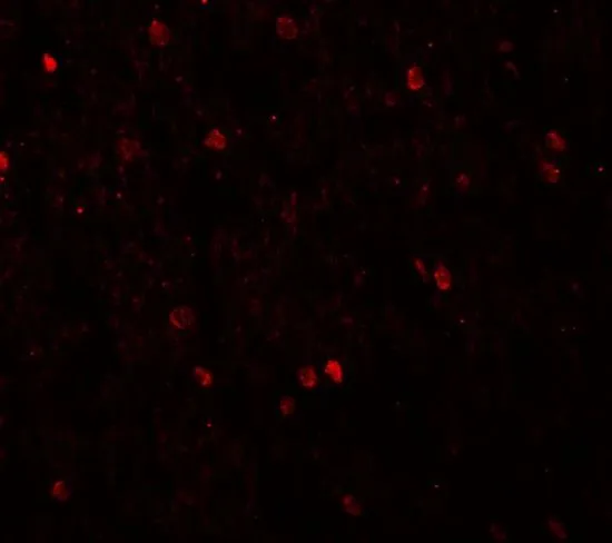 IHC-P analysis of human brain tissue using GTX31480 SHANK3 antibody. Working concentration : 20 microg/ml