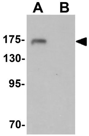 WB analysis of 3T3 cell lysate in (A) the absence and (B) the presence of blocking peptide using GTX31480 SHANK3 antibody. Working concentration : 1 microg/ml